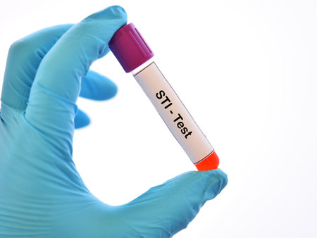 Blood sample for sexually transmitted infection (STI) testの写真素材