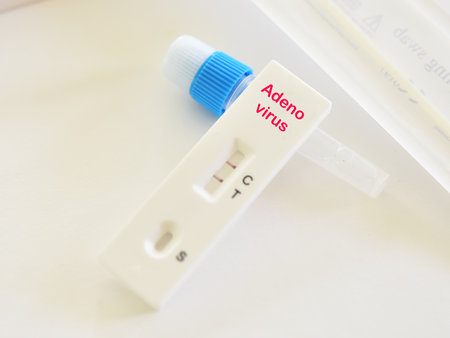 Adenovirus positive test result by using rapid test deviceの写真素材