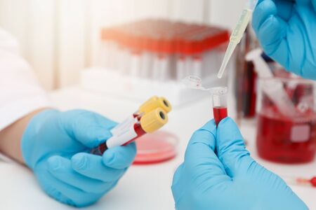 Research and development concept, Laboratory scientist researching covid-19(corona virus) vaccine at...