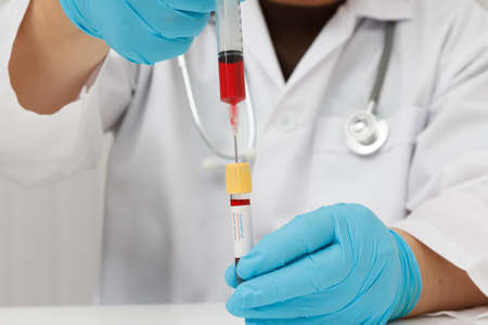 Research and development concept, Laboratory scientist researching covid-19(corona virus) vaccine at...