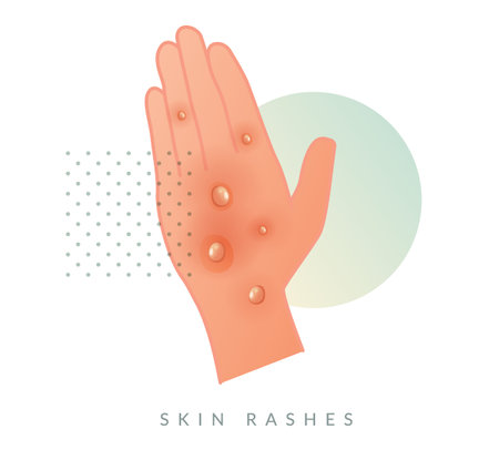 Monkeypox - Skin Rashes and Spots as Symptoms - Icon as EPS 10 Fileのイラスト素材