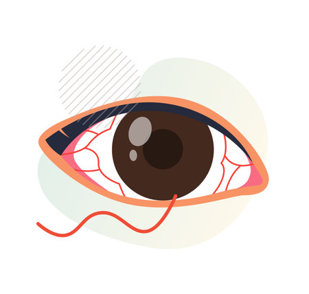 Conjunctivitis Infection in Eye - Pink Eye - Icon as EPS 10 Fileのイラスト素材