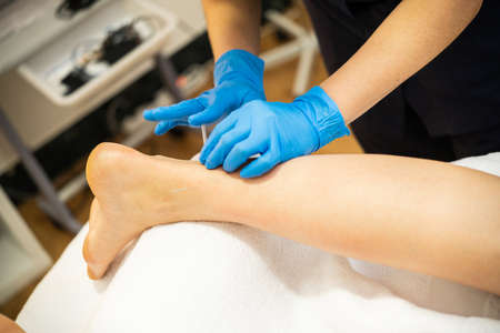 Hands of physiotherapist doing a dry needlingの写真素材