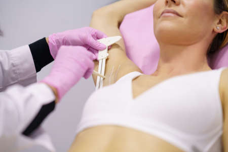 Doctor painting on the armpit of her patient, the area to be treated for hyperhidrosis.の写真素材