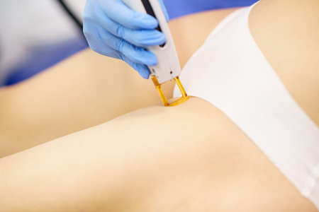 Woman receiving groins laser hair removal at a beauty center.の写真素材