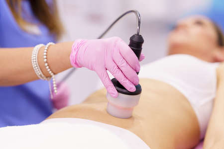 Woman receiving anti-cellulite treatment with radiofrequency machine in an aesthetic clinic.の写真素材
