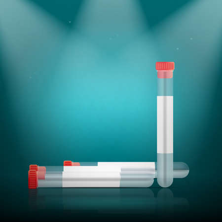 Tubes for blood samples or medicines. Realistic plastic tube with sample of results for coronavirus positive-negative. Vector illustration.のイラスト素材