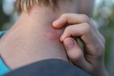 mosquito bite on a teenager's neck, the boy scratches the bite site.
