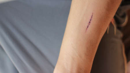 fake cut on arm
