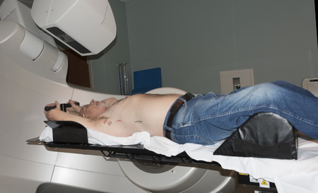 Patient Radiation therapy laser markings lines for targeting cancer cells in the Chestの写真素材