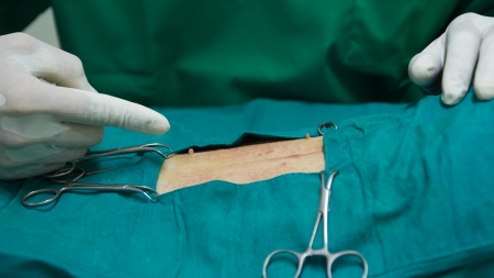 Veterinarian sterilization operation on  dogの写真素材