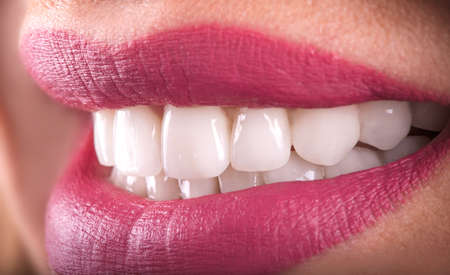 Perfect Close Up White beautiful Veneers Teeth bleaching crowns whitening young lady smiling, Sensual Seductive plump Lips woman smile. Dental zircon implants restoration surgery. Fashion conceptの写真素材