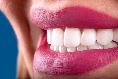 Perfect Close Up White beautiful Veneers Teeth bleaching crowns whitening young lady smiling,...