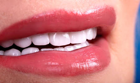 Perfect Close Up White beautiful Veneers Teeth bleaching crowns whitening young lady smiling,...