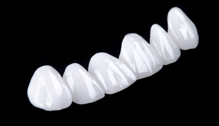Ceramic dentures and crowns on black background. Top view on set of single dentures and dental crowns. Zirconium crown and zirconium hybrid press on isolated black background.の写真素材