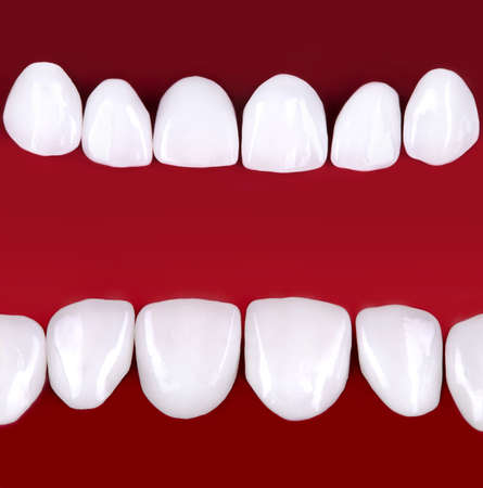 Ceramic dentures and crowns on black background. Top view on set of single dentures and dental crowns. Zirconium crown and zirconium hybrid press on isolated black background.の写真素材