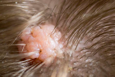 head with a wart coming hair outの写真素材