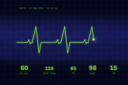 A graph of normal heartbeat on a blue monitorの写真素材