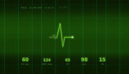 A graph of normal heartbeat on a green monitorの写真素材