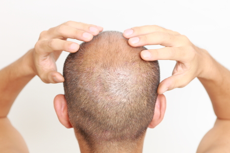 scalp massage