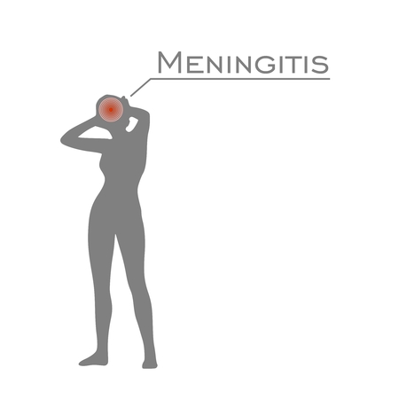 Young lady rise her hands to head. Meningitis text. Silhouette of woman suffering from head migraine. Stressed exhausted young woman having strong tension headacheのイラスト素材
