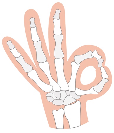 x-ray hand isolated on white background vectorのイラスト素材