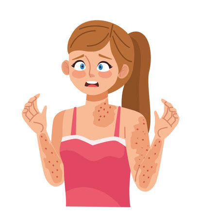 monkeypox infected womanのイラスト素材