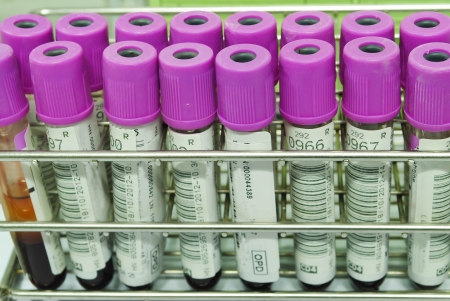 a view blood tubes in detailのeditorial素材