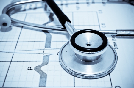 stethoscope on a cardiogramの写真素材