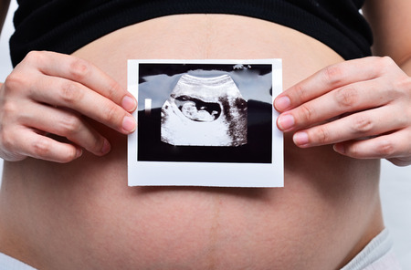 Pregnant Lady Showing Ultrasoundの写真素材