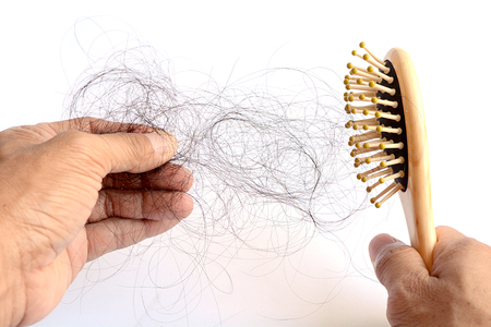 Hair loss, hair fall everyday serious problem, on white background.の写真素材