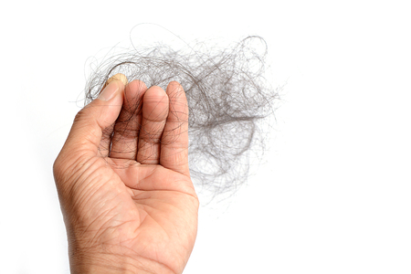 Hair loss, hair fall everyday serious problem, on white background.の写真素材