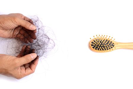 Hair loss, hair fall everyday serious problem, girl with a comb and problem hair.の写真素材