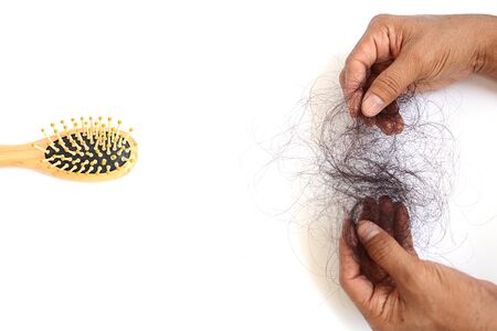 Hair loss, hair fall everyday serious problem, girl with a comb and problem hair.の写真素材