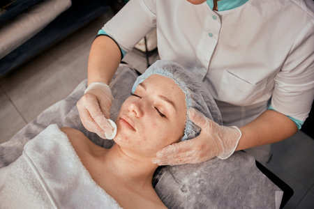 A female cosmetologist cleanses the clients face with acne with cotton pads. Professional beauty...