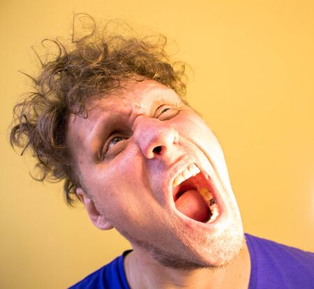 A man with an open mouth. He has a toothache. At the doctor.の写真素材