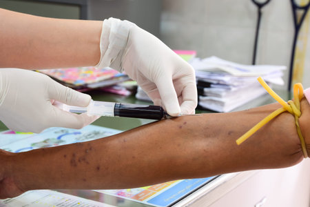 Nurse collecting a blood from a patient for laboratory research
