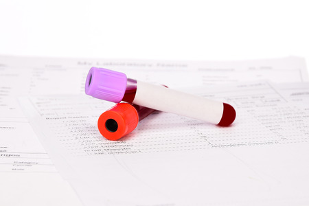 Blank blood test tube on blood test form background.の写真素材