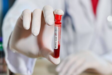 Blood test tube in doctor hand, Mers-CoV Coronavirus test Positive label in hospital blood test tube for analysis. 2019-nCoV virusの写真素材