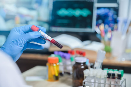 HIV VDRL label Blood test tube in Medical Scientist hand in Laboratory room at hospital, blood test...
