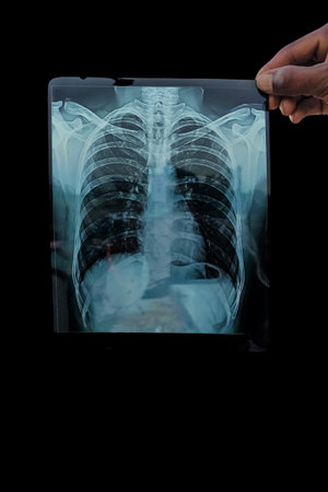 A Human Skeleton System Bone Joints Anatomy Photos
