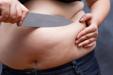 Weight loss, overweight, dieting, plastic surgery, liposuction cの写真素材