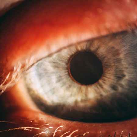 enlarged image of an eye iris made with a slit lampの写真素材