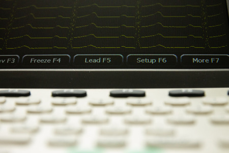 Electrocardiograph medical device with screen and keyboard, front view. Screen showing cardiography heart leads.の写真素材