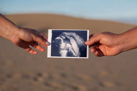 Couple hands holding ultrasound picture of their daughter.Pregnancy concept.の写真素材