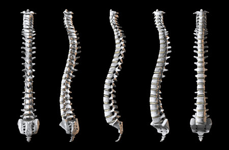 A total of five human spines shown at 5 angles to rerveal the whole object. 