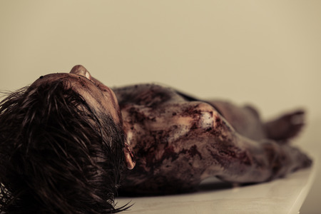 Close up Burnt Body of a Dead Young Boy Lying on the Table in Morgue, Emphasizing Head and Shoulder.