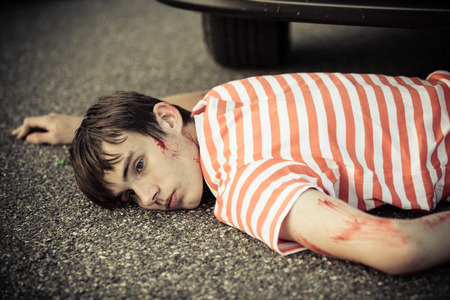 Unconscious boy with head injury, eyes open and scratched arm laying down in front of stopped carの写真素材