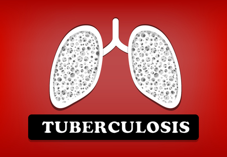 Tuberculosis, Lung Cancer in vector art designのイラスト素材