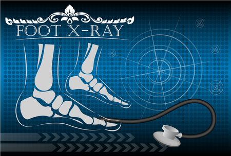 Foot x-rayのイラスト素材